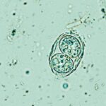 A microscope image of a Toxoplasma gondii oocyte. The background is light green. The parasite appears as two round cells encased in an oval outer shell.